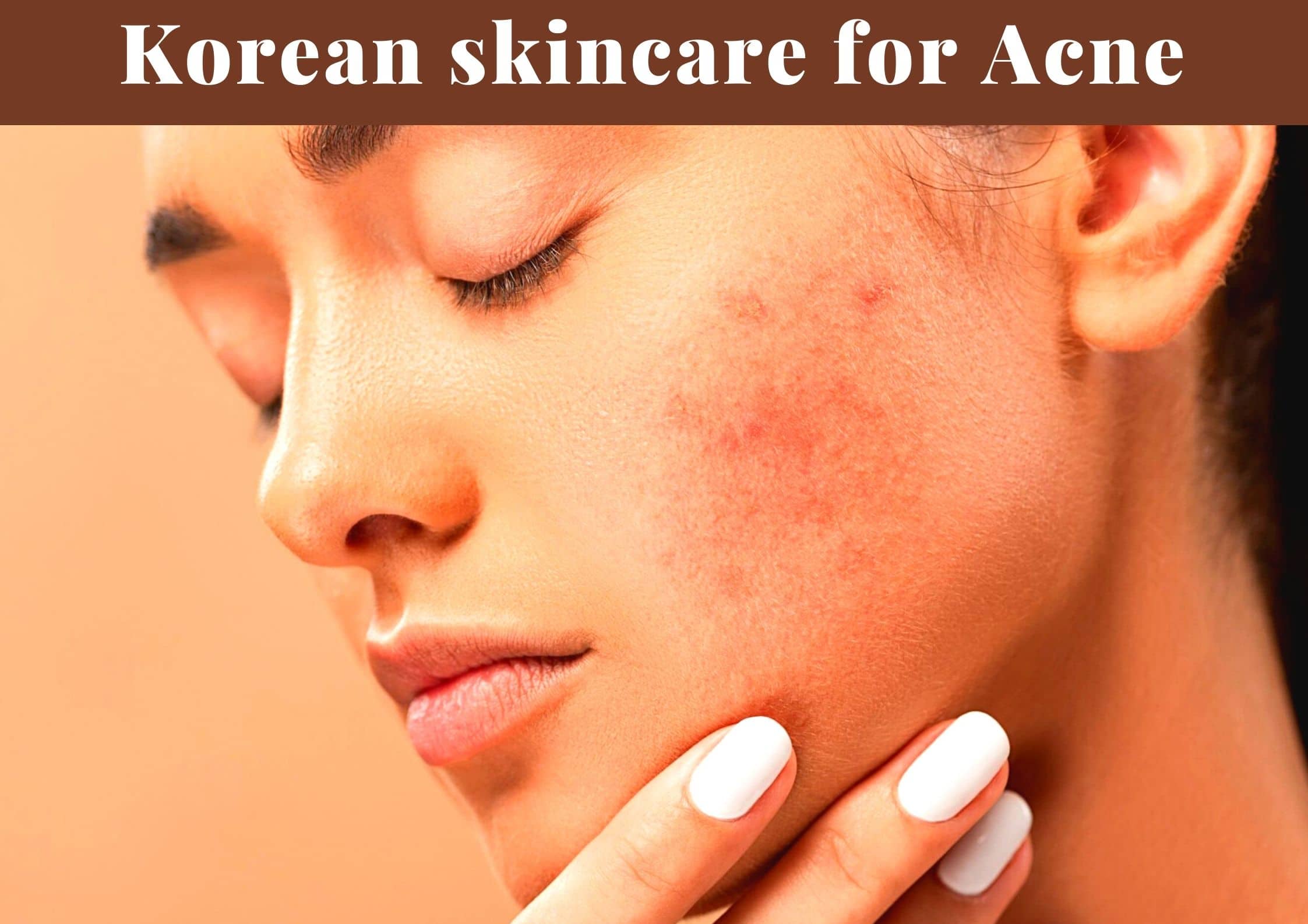 best korean skincare products for acne