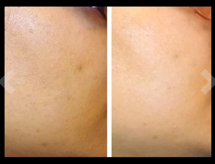 best korean serum for brightening