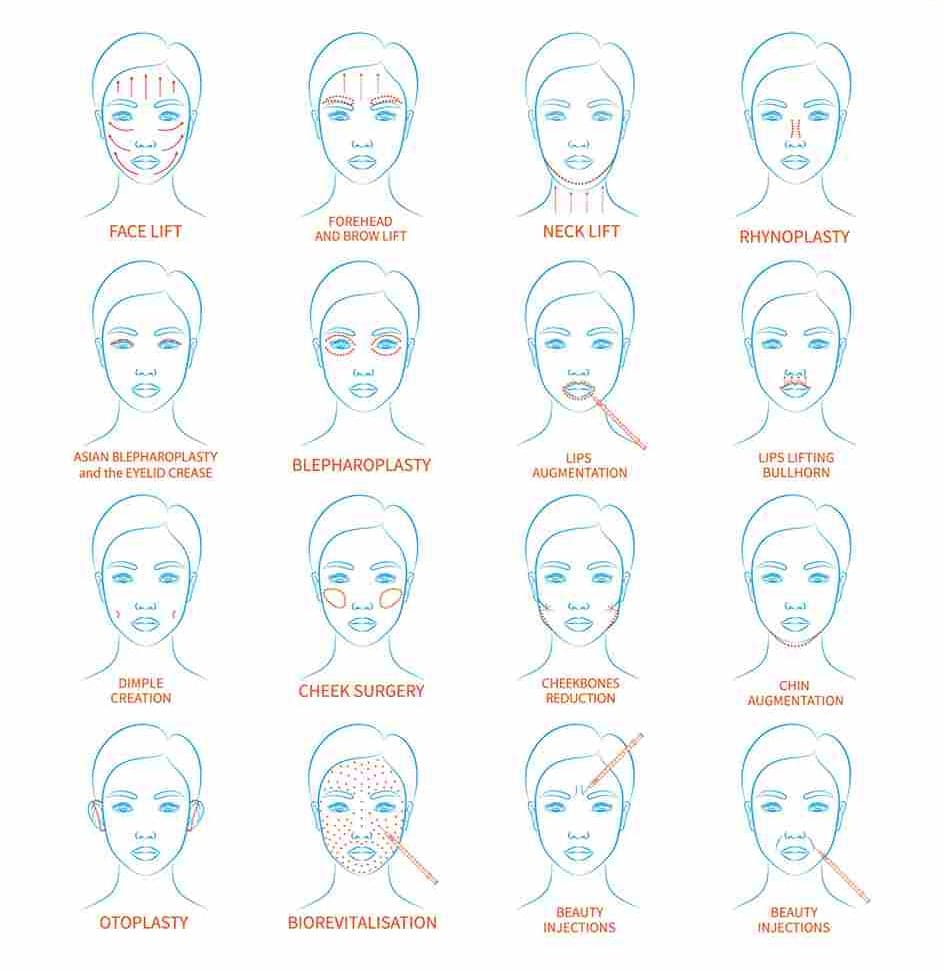 most common plastic surgery in korea